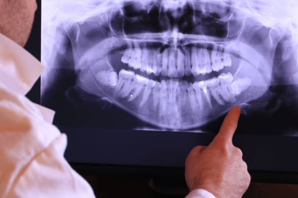 Best Emergency TMJ Treatment in Richland Hills, TX