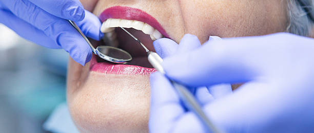 Best Emergency Gum Treatment in Richland Hills, TX